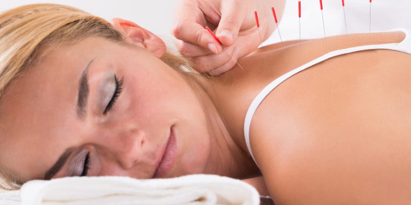 Acupuncture in Springfield Missouri - reduces stress