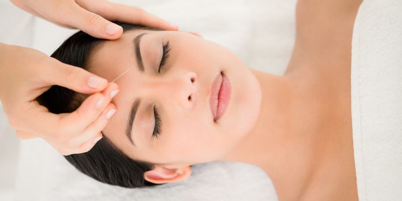 Acupuncture in Springfield Missouri - relieves headaches